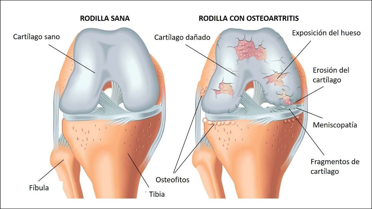 Laboratorio estudiando salud articular